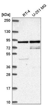 Western Blot: SFMBT1 Antibody [NBP2-56939]