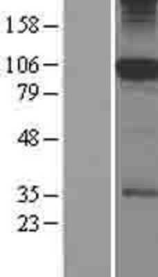 Western Blot: SFMBT1 Overexpression Lysate [NBL1-15880]