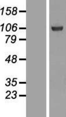 Western Blot: SFMBT1 Overexpression Lysate [NBL1-15881]