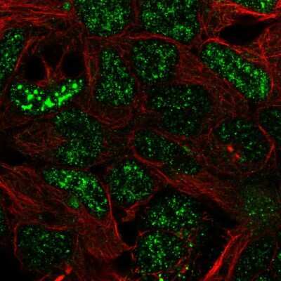 Immunocytochemistry/ Immunofluorescence: SFMBT2 Antibody [NBP2-34005]