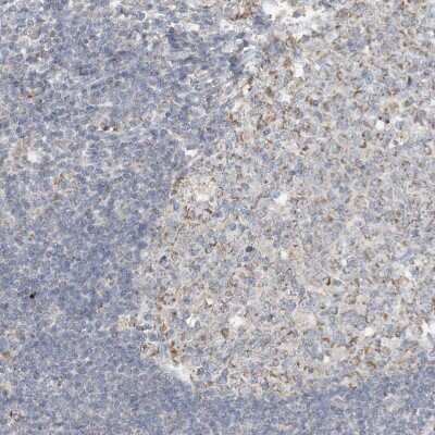 Immunohistochemistry-Paraffin: SFMBT2 Antibody [NBP2-34005]