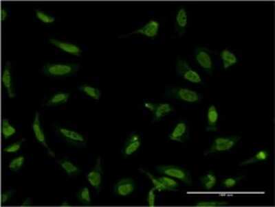 Immunocytochemistry/ Immunofluorescence: SFPQ Antibody (3B10) [H00006421-M01]