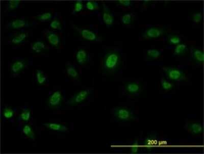 Immunocytochemistry/ Immunofluorescence: SFPQ Antibody (6D7) [H00006421-M02]