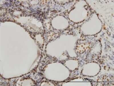 Immunohistochemistry-Paraffin: SFPQ Antibody (6D7) [H00006421-M02]