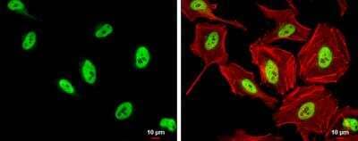 Immunocytochemistry/ Immunofluorescence: SFPQ Antibody [NBP2-20329]