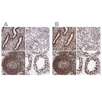 Immunohistochemistry-Paraffin: SFPQ Antibody [NBP2-48876]