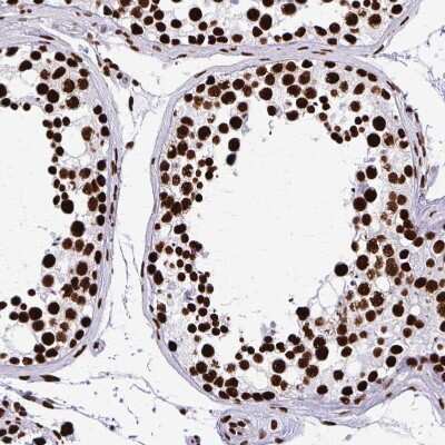 Immunohistochemistry-Paraffin: SFPQ Antibody [NBP2-48876]