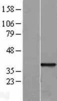 Western Blot: sFRP-1 Overexpression Lysate [NBL1-15883]