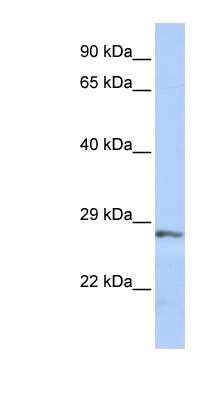 Western Blot: sFRP-2 Antibody [NBP1-56609]