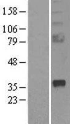 Western Blot: sFRP-2 Overexpression Lysate [NBL1-15884]