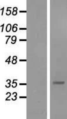 Western Blot: sFRP-5 Overexpression Lysate [NBP2-08048]