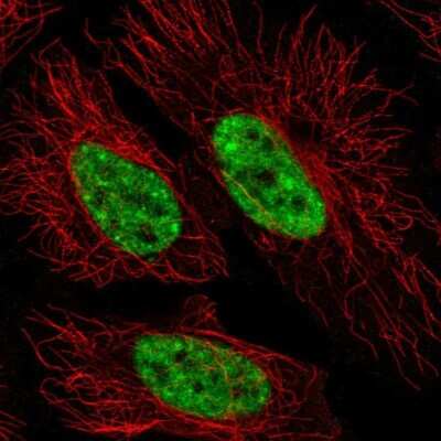 Immunocytochemistry/ Immunofluorescence: SFRS12 Antibody [NBP2-57236]