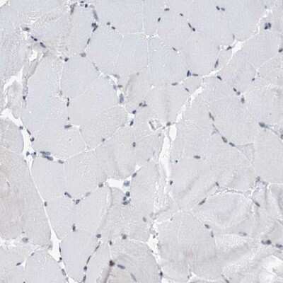 Immunohistochemistry-Paraffin: SFRS12 Antibody [NBP1-87993]
