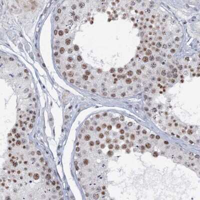 Immunohistochemistry-Paraffin: SFRS12 Antibody [NBP1-87993]