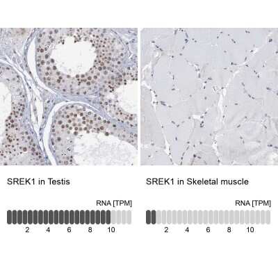 Immunohistochemistry-Paraffin: SFRS12 Antibody [NBP1-87993]