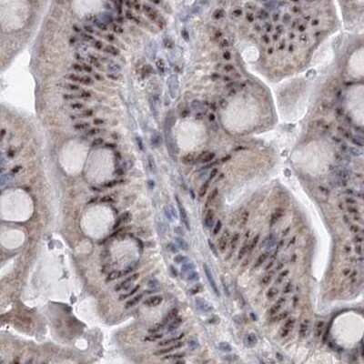 Immunohistochemistry-Paraffin: SFRS12 Antibody [NBP1-87993]
