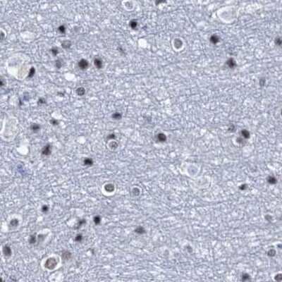 Immunohistochemistry-Paraffin: SFRS12 Antibody [NBP1-87993]