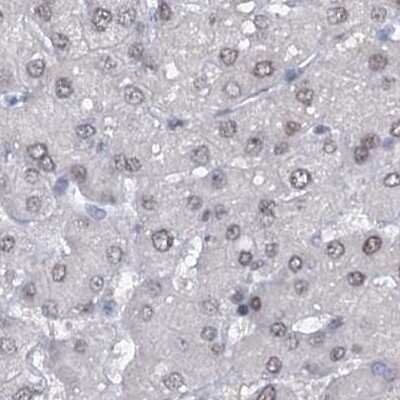 Immunohistochemistry-Paraffin: SFRS12 Antibody [NBP1-87993]