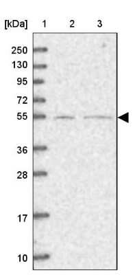 Western Blot: SFRS12 Antibody [NBP1-87993]