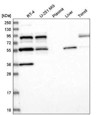 Western Blot: SFRS12 Antibody [NBP2-55143]