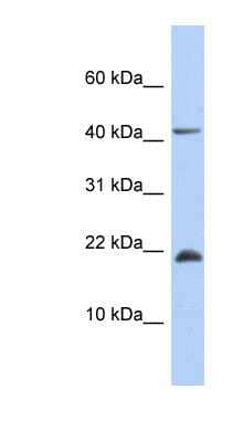 Western Blot: SFRS12IP1 Antibody [NBP1-54710]