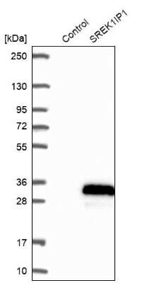 Western Blot: SFRS12IP1 Antibody [NBP2-47280]