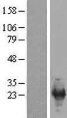 Western Blot: SFRS12IP1 Overexpression Lysate [NBP2-05106]