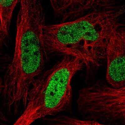 Immunocytochemistry/ Immunofluorescence: SFRS14 Antibody [NBP2-38906]