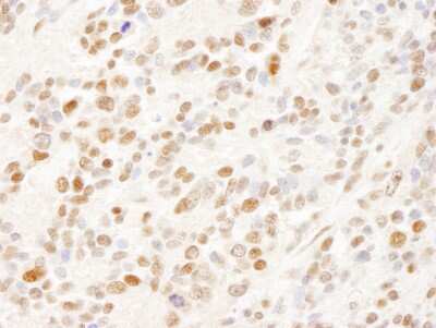 Immunohistochemistry: SFRS14 Antibody [NB100-79849]