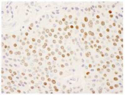 Immunohistochemistry-Paraffin: SFRS14 Antibody [NB100-79849]