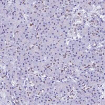Immunohistochemistry-Paraffin: SFRS14 Antibody [NBP1-87868]