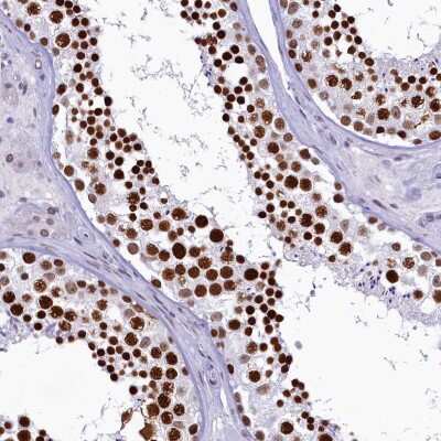 Immunohistochemistry-Paraffin: SFRS14 Antibody [NBP1-87868]