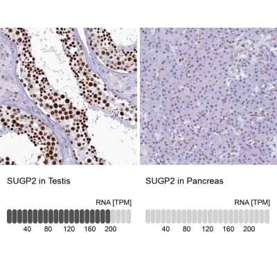 Immunohistochemistry-Paraffin: SFRS14 Antibody [NBP1-87868]
