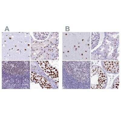 Immunohistochemistry-Paraffin: SFRS14 Antibody [NBP1-87868]