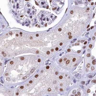 Immunohistochemistry-Paraffin: SFRS14 Antibody [NBP1-87868]