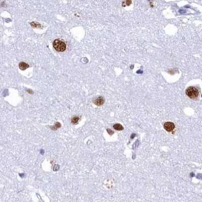 Immunohistochemistry-Paraffin: SFRS14 Antibody [NBP1-87868]
