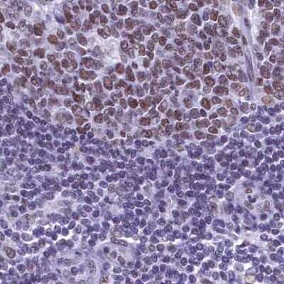 Immunohistochemistry-Paraffin: SFRS14 Antibody [NBP1-87868]