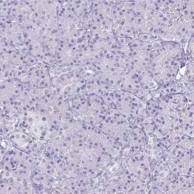 Immunohistochemistry-Paraffin: SFRS14 Antibody [NBP2-38906]