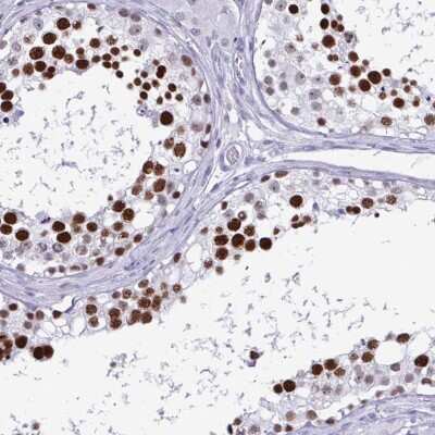 Immunohistochemistry-Paraffin: SFRS14 Antibody [NBP2-38906]