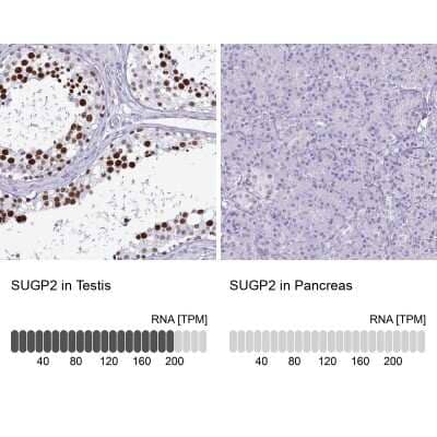 Immunohistochemistry-Paraffin: SFRS14 Antibody [NBP2-38906]