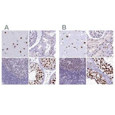 Immunohistochemistry-Paraffin: SFRS14 Antibody [NBP2-38906]
