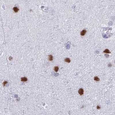 Immunohistochemistry-Paraffin: SFRS14 Antibody [NBP2-38906]