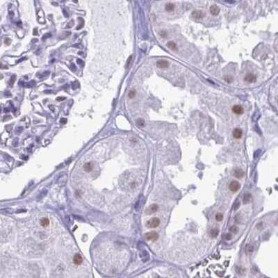 Immunohistochemistry-Paraffin: SFRS14 Antibody [NBP2-38906]