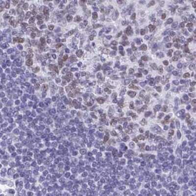 Immunohistochemistry-Paraffin: SFRS14 Antibody [NBP2-38906]