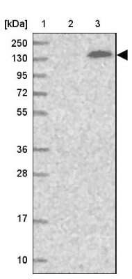 Western Blot: SFRS14 Antibody [NBP1-87868]