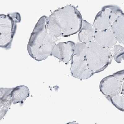 Immunohistochemistry-Paraffin: SFRS15 Antibody [NBP1-88001]
