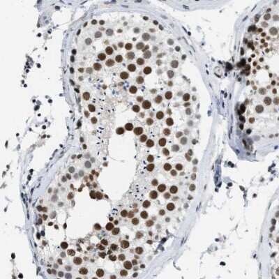 Immunohistochemistry-Paraffin: SFRS15 Antibody [NBP1-88001]