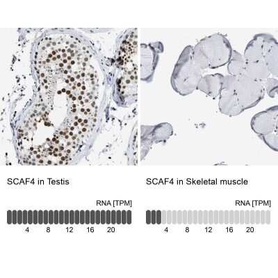 Immunohistochemistry-Paraffin: SFRS15 Antibody [NBP1-88001]