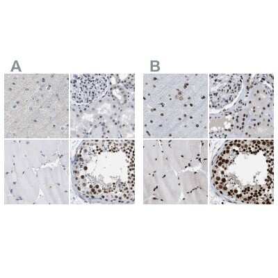 Immunohistochemistry-Paraffin: SFRS15 Antibody [NBP1-88001]