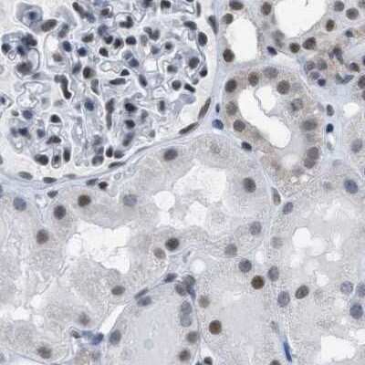 Immunohistochemistry-Paraffin: SFRS15 Antibody [NBP1-88001]